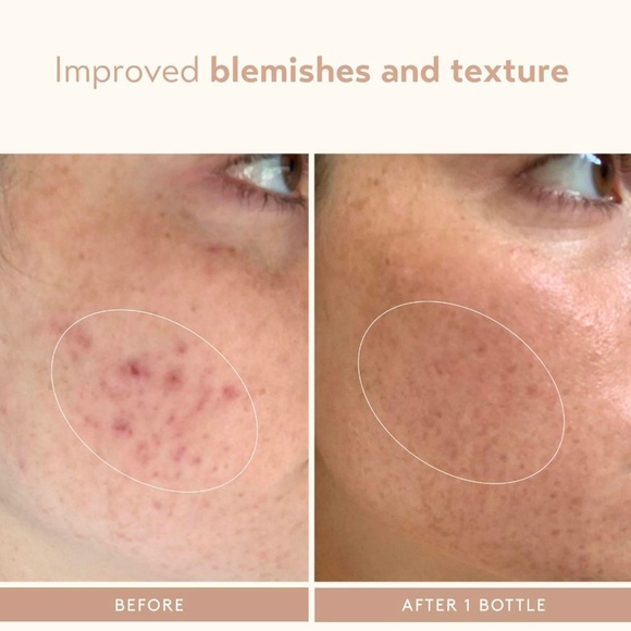 🌿 SHANI DARDEN SKIN CARE Retinol Reform® + Lactic Acid AHA Exfoliating Serum - Picture 5 of 14